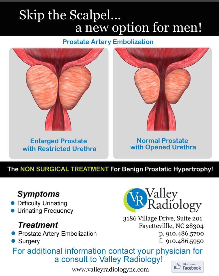 Minimally Invasive Prostate Artery Embolization Procedure Valley Radiology