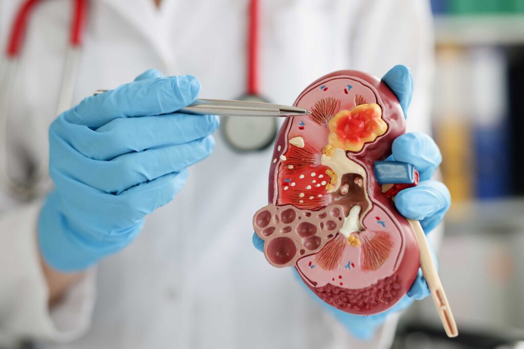 Doctor pointing to parts of the kidney